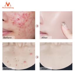 Thumbnail MeiYanQiong Xà bông rửa mặt  than tre đen loại bỏ mụn đầu đen kiềm dầu se khít lỗ chân lông lớn hiệu quả 4