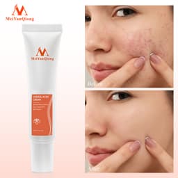 Thumbnail MeiYanQiong Kem dưỡng Hỗ Trợ Giảm Mụn cải thiện da thô ráp xỉn màu làm sáng màu da 15g 2