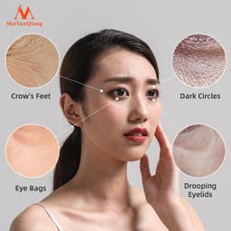 Thumbnail MeiYanQiong Tái TạoTinh Chất Dưỡng Da Vùng Mắt Chống Lão Hóa Loại Bỏ Nếp Nhăn Rejuvenating eye Serum12ml 2