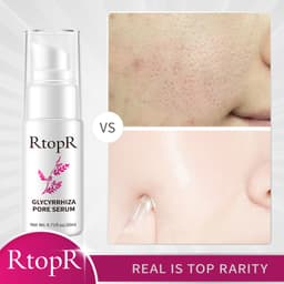 Thumbnail RtopR Tinh chất phục hồi lỗ chân lông Glycyrrhiza 20ml 3