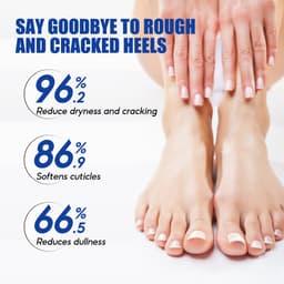 Thumbnail Kem dưỡng urê 60% - chứa dầu cây trà, dầu dừa và axit salicylic - kem tay urê để nứt - dưỡng ẩm, làm mịn và săn chắc da 4