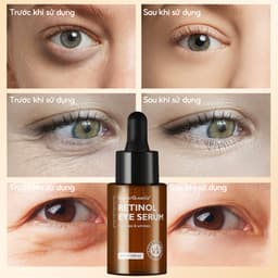 Thumbnail Tinh chất dưỡng mắt Retinol VIBRANT GLAMOUR Chống lão hóa Chống nhăn và bọng mắt 30ml 1