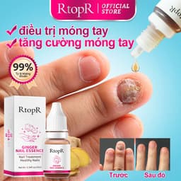 Thumbnail Tinh chất gừng RTOPR kháng khuẩn hỗ trợ giảm bệnh nấm móng chân 10ml 1