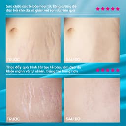 Thumbnail RtopR Xoài Xóa Sẹo Mang Thai Kem Rạn Da Kem Làm Săn Chắc Cơ Thể 40g RtopR Mango Remove Pregnancy Stretch Marks Maternity Cream 4