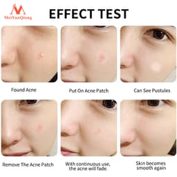 Thumbnail Meiyanqiong Miếng dán lột mụn đầu đen Sửa chữa và làm sạch sâu da mặt 24 viên 4