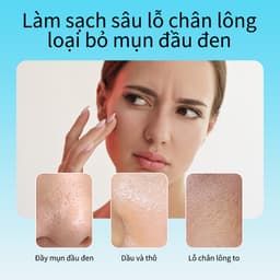 Thumbnail Mặt nạ lột mụn đầu đen RTOPR làm sạch sâu lỗ chân lông dưỡng ẩm kiềm dầu chuyên cải thiện làn da thô ráp 40g 2