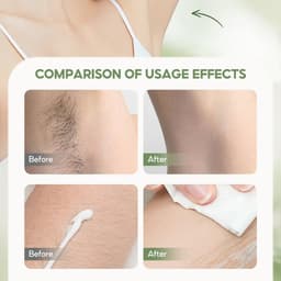 Thumbnail Kem tẩy lông SUMAX Kem tẩy lông toàn thân Thành phần thực vật Không gây kích ứng Loại bỏ lông không đau 4