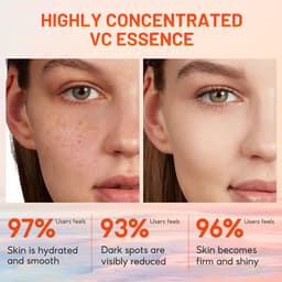 Thumbnail MeiYanQiong Tinh serum dưỡng ẩm vc làm sáng sắc tố chống lão hóa dưỡng ẩm và làm trắng da12ml 3