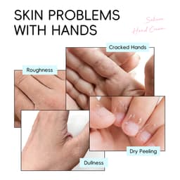 Thumbnail Kem dưỡng da tay LAIKOU hoa anh đào Nhật Bản nuôi dưỡng làm sáng phục hồi làn da thô ráp cao cấp 30g 2
