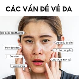 Thumbnail Mặt nạ bùn gel VIBRANT GLAMOUR 5g nhiều loại hỗ trợ giảm mụn chống lão hóa se khít lỗ chân lông 2