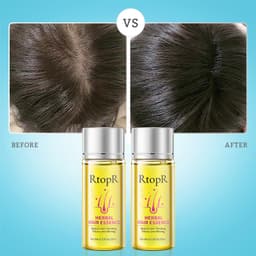 Thumbnail Rtopr 2 Cái Thảo Dược Tóc Tăng Trưởng Chống Rụng Tóc Chất Lỏng Thúc Đẩy Dày Nhanh Tóc Điều Trị Tăng Trưởng Tinh Dầu 2