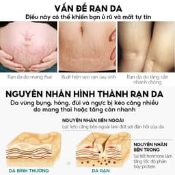 Thumbnail Kem Hỗ Trợ Giảm Sẹo Sau Khi Sinh VIBRANT GLAMOUR Làm Trắng Và Săn Chắc Mịn Mượt Chống Lão Hóa 30g 1