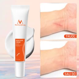 Thumbnail MeiYanQiong Kem sẹo Giảm Sẹo lồi/lõm/sẹo thâm do mụn/phục hồi các tổn thương trên da/thúc đẩy tái tạo da 15ml 3
