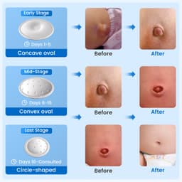Thumbnail Velpeau Đai thoát vị rốn cho bé Sơ sinh Trẻ sơ sinh Giàn rốn Nút bụng Dây đeo phục hồi với 3 miếng nén Chống trượt 3