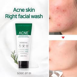 Thumbnail Sữa Rửa Mặt Ngừa Mụn Some By Mi AHA-BHA-PHA 30 Days Miracel Acne Clear Foam 2