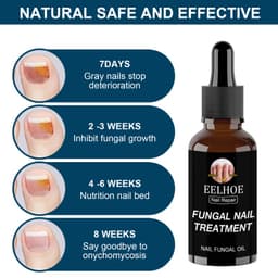 Thumbnail Tinh chất phục hồi móng EELHOE ANNIES 30ml/ 50ml loại bỏ nấm chăm sóc móng tay móng chân 4