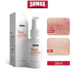 Thumbnail Chai xịt ức chế mọc lông SUMAX thích hợp cho vùng tay/ chân/ nách/ bikini cho nam nữ 30ml100g 1