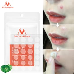 Thumbnail MeiYanQiong Miếng dán lột mụn giảm mụn đầu đen Phục Hồi àm làm  sạch sâu Da cho vùng mũi 24 viên 4