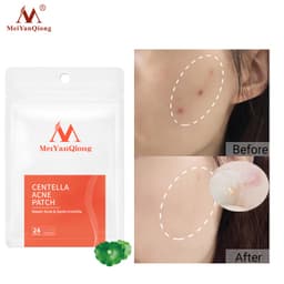 Thumbnail MeiYanQiong Miếng dán lột mụn giảm mụn đầu đen Phục Hồi àm làm  sạch sâu Da cho vùng mũi 24 viên 2