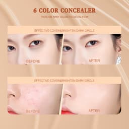 Thumbnail Kem Che Khuyết Điểm Dạng Lỏng IMAGIC Lâu Trôi Chống Nước Che Quầng Thâm Và Vết Mụn Trên Mặt 32g 1