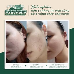 Thumbnail Tinh chất giảm mụn mờ thâm Caryophy Portulaca Ampoule 30ml 3