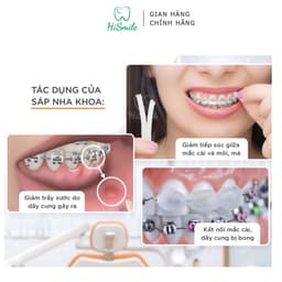 Thumbnail SÁP NHA KHOA Dynaflex dành cho người chỉnh nha 2