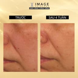Thumbnail Serum làm trắng sáng da IMAGE Skincare ILUMA Intense Brightening Serum 30ml 4