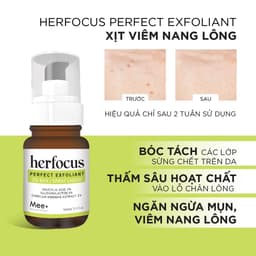 Thumbnail Xịt viêm nang lông HERFOCUS 100ml + Sữa tắm viêm nang lông HERFOCUS 500ml - Bộ liệu trình viêm nang lông Mee Natural 3