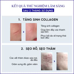 Thumbnail Kem làm mờ sẹo thâm, lấp đầy sẹo rỗ, lõm Scar Esthetique REJUVASKIN 30ml 3