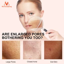 Thumbnail MeiYanQiong Tinh chất Pore Se Giúp Thu Nhỏ Lỗ Chân Lông Và Làm Sáng Da 10ml 2