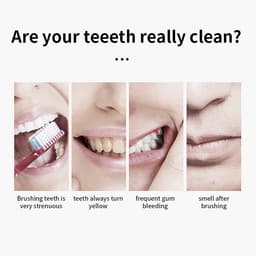 Thumbnail Bàn Chải Đánh Răng Điện Tử sonic 6 Đầu Thay Thế + 1 Giá Đỡ 2