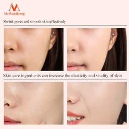 Thumbnail MeiYanQiong Mặt Nạ 50g Tẩy Tế Bào Chết Hỗ Trợ Cải Thiện Mụn Đầu Đen Và Se Khít Lỗ Chân Làm Sạch Sâu Kiểm Soát Dầu Mặt Nạ Loại Bỏ Sóc Da Hiệu Quả Dưỡng Trắng Da Cấp ẩm Chống Lão Hóa 40g 3