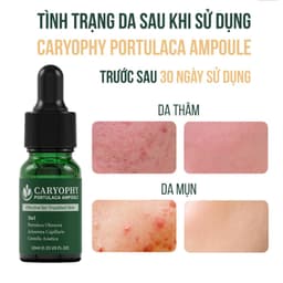 Thumbnail Serum rau má giảm mụn mờ thâm Caryophy Portulaca Ampoule (10ml 30ml) 4