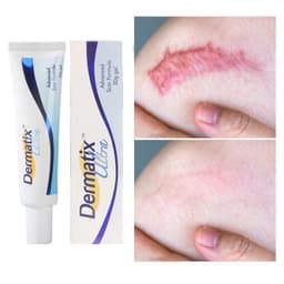 Thumbnail Kem giảm sẹo EELHOE Dermatix 15g hỗ trợ giảm sẹo mụn phục hồi 2