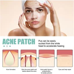 Thumbnail Set 132 Miếng Dán Hỗ trợ giảm mụn EELHOE Cao Cấp 4