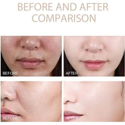 Thumbnail Gel tẩy tế bào chết Grantadmit, Gel tẩy tế bào chết thanh lọc Grantadmit, Thanh lọc để làm sạch sâu mặt, Tẩy tế bào chết cho mặt, Sữa rửa mặt nhẹ nhàng cho mọi loại da, Làm sạch bụi bẩn 2