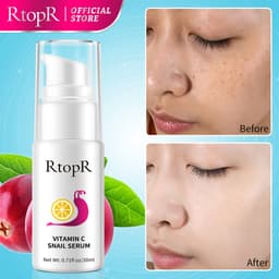 Thumbnail Serum Dưỡng Da Trắng Da RtopR Chiết Xuất Ốc Sên/Vitamin C Chống Nếp Nhăn Săn Chắc Và Trẻ Hóa Làn Da Hiệu Quả Vitamin C Brightening 20ML 1
