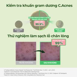 Thumbnail Sữa rửa mặt tạo bọt làm sạch da BALANCEFUL CICA, 150ml , Cleansing Foam 2