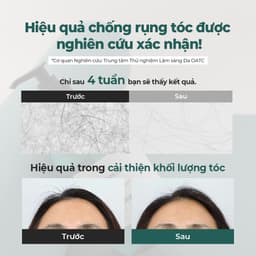 Thumbnail Dầu gội Root Booster 500ml [Dầu gội chống rụng tóc số 1, 22 loại axit amin, 6 loại nguyên liệu tự nhiên] 4