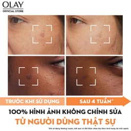 Thumbnail Kem Dưỡng Ẩm OLAY LUMINOUS NIACINAMIDE + VITAMIN C 50G Mờ Vết Thâm, Đốm Nâu, Dưỡng Sáng Da 4