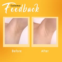 Thumbnail Serum nách che khuyết điểm, hỗ trợ giảm thâm nách & làm sáng nách BareSoul OMG Underarm Serum 20G 2