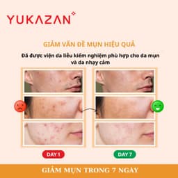 Thumbnail Kem Giảm Mụn, Giảm Viêm Yukazan Refining Cream 5ml - Công Thức Thảo Mộc Japan Murasaki 2