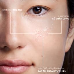 Thumbnail Nước cân bằng (toner) giàu khoáng dành cho da dầu La Roche-Posay Effaclar Astringent Lotion 200ml 4