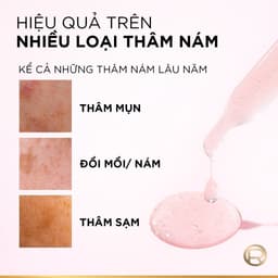 Thumbnail Serum Glycolic Melasyl 8% [Melasyl+Glycolic+Niacinamide] dưỡng sáng da, mờ thâm mụn & nám Loreal Paris 30ml 4