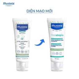 Thumbnail Kem Dưỡng Mặt Cho Da Chàm Thể Tạng (Viêm Da Cơ Địa) Mustela Stelatopia Emollient Face Cream 40ml 2