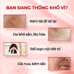 Thumbnail Viên uống đẹp da Sắc Ngọc Khang++ [Hộp 60v] giúp chống lão hóa, giảm nám sạm & cân bằng nội tiết tố nữ 1