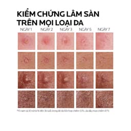 Thumbnail Kem dưỡng giảm mụn nhanh 8 giờ La Roche-Posay Effaclar Duo+ M 7.5ml 3