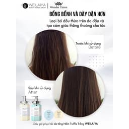 Thumbnail Dầu Gội Weilaiya Phục Hồi Đa Tầng Nấm Truffle Weilaiya 450ml 4
