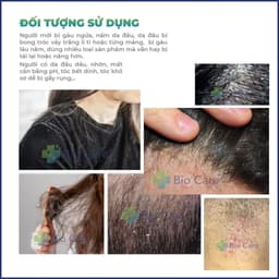 Thumbnail Dầu gội dược liệu BIO CARE PHARMA giảm gàu, nấm ngứa da đầu Santal 300 Shampoo 100ml 2