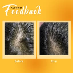 Thumbnail Combo sạch sâu, sáng mịn, dưỡng ẩm cho da và môi BareSoul BLISS Body Hair Scrub 330g + Sweet Talker Lip Scrub 20g 4